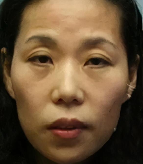 脸颊凹陷怎么能变圆润 2026年脸颊凹陷怎么能变圆润按摩方法