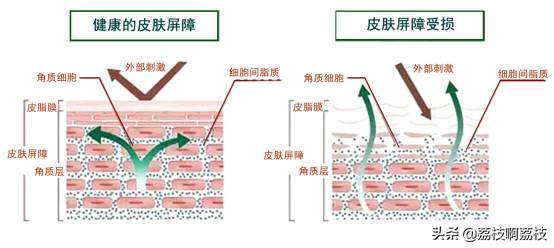 抹任何一款护肤品，皮肤都刺痛，是缺水还是过敏？