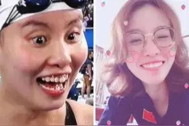 终于相信baby没“整容”了！看她“整牙”前后，看后让你怀疑眼睛图片