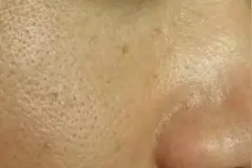 毛孔粗大只因这4件事做多了，坚持3个好习惯，毛孔变小皮肤细腻图片