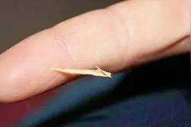 手上扎了刺千万别用针挑，学会这招，不疼不痒去除手上木刺！视频封面
