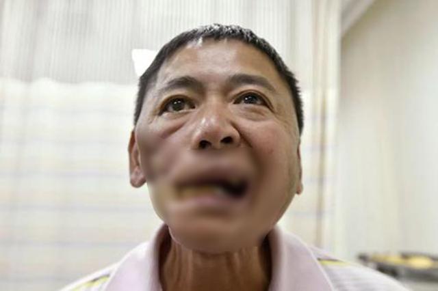 槟榔之殇：成瘾只是表象，6000万人的爱好，如何成割脸的诱因