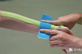 功能性贴扎技术有效手法结合治疗卒中后上肢肌张力障碍图片