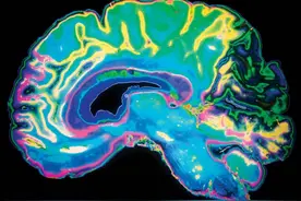 星形胶质细胞：你所不知的大脑另一面图片