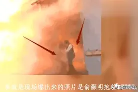 十年前震惊娱乐圈的Selina俞灏明烧伤意外，留下太多谜团…图片