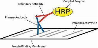 生物科研狗必备技能之~Western Blot