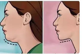 女人到了一定年纪，是少女感还是大妈感，看脸上这3条“线”就行图片