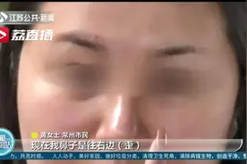 女子想要“网红鼻”，术后却成歪鼻子！期间医生私换假体高度还不告知…图片