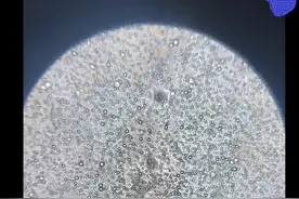 显微镜下，被放大了1000倍的母乳竟然是“活”的：母亲很伟大图片