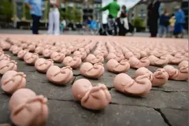 被“人流”打掉的胎儿去哪了？看到这些处理方式，许多女性泪目图片