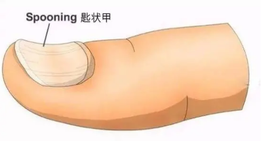 怎么把角化为弧度