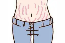 生长纹、肥胖纹、妊娠纹，身上的“纹”是怎么出来的？图片