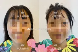 吸脂手术有什么风险？哪些人适合做？图片