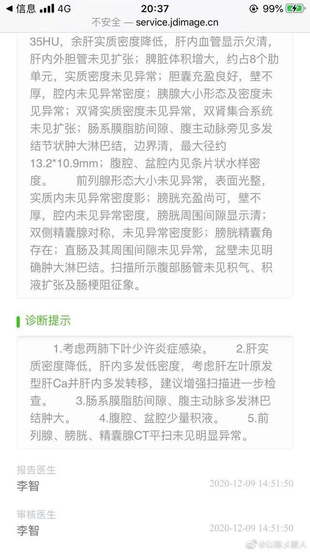 肝癌中期可以治好吗?（得了肝癌中期）