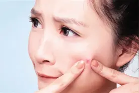 挤痘痘有可能丧命！19岁女孩挤痘导致颅内感染，住进医院图片
