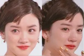 鼻头越缩越大——“瘦身”变“增肥”，原因在谁？图片