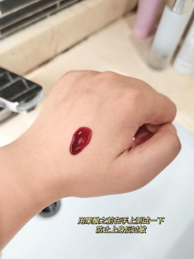 给鸡皮肤刷酸可以吗