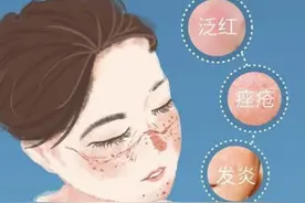 爆痘、过敏都是戴口罩惹的祸？深圳皮肤科医生实验后公布真相图片