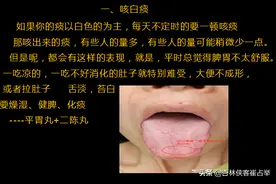 咳白痰、黄痰、清稀泡沫痰，3种情况3种原因，教你一分钟辨别图片