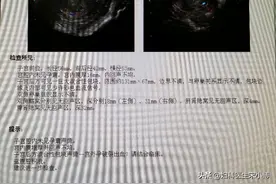 【你真的了解宫外孕吗?---一例输卵管间质部女妊娠破裂分享】图片