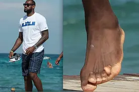 NBA球星有多不容易？詹姆斯穿世界上最好的鞋，脚趾依旧变形严重图片