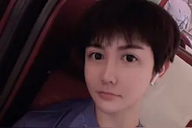 还记得整容界网红刘梓晨吗？相比之前也帅太多了吧？图片