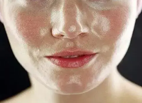 吐血整理的护肤清单！油皮、干皮、敏感肌、混合皮到底都在用啥