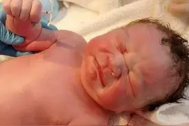 嵌在妈妈体内的小铜环，已经伤害了中国女性20年：子宫自由有多难图片