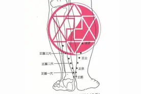 中医针灸治疗头疼配穴4图片