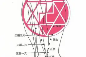 中医针灸治疗头疼配穴4图片