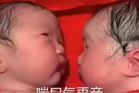 刚出生的龙凤胎，哥哥紧紧抱着妹妹，护士都分不开图片