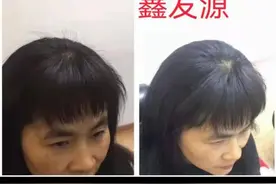 白发转黑，你能配合，肯定出效果图片