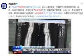 成年人还能不能长高？一文揭开增高针、增高药的真相图片