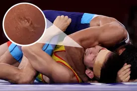 哈萨克斯坦奥运摔跤手用力撕咬对手二头肌，牙印清晰可见，双输图片