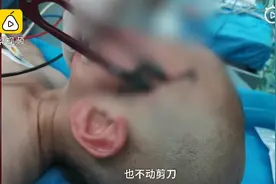 警惕！2岁男童摔倒手中剪刀刺破脑膜，经治疗脱离生命危险图片