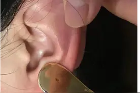 睡不着数绵羊没用 耳穴疗法助眠有妙招图片