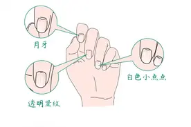 赶紧看看你的指甲，出现这种状况可能是生病了图片