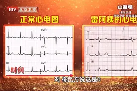 心跳过慢、过快、乱跳，都是因为它出了问题！赶紧摸脉自测一下图片