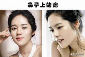 看看身体上的7个位置的痣如何显现出一个人的个性图片