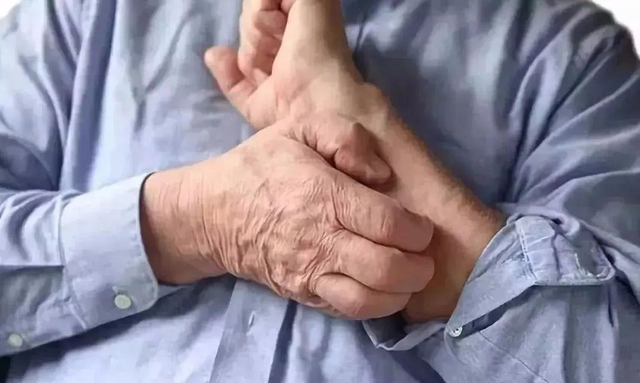 皮肤角化上皮瘤