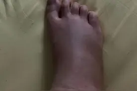 “夺命蚁”入侵，有人被咬死，有人双目失明！图片