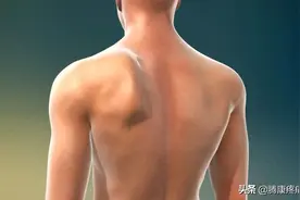 翼状肩原因分析与纠正方法图片