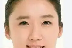 面部动作矫正，真的可以简单快速的改善脸部问题吗图片