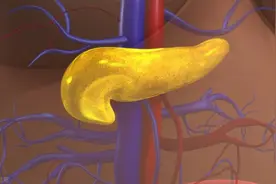 爸妈注意了，小孩脖子发黑，不是洗不干净！小心糖尿病找上门图片