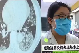 避免过度消毒！河南两女子因过度消毒致肺泡炎！图片