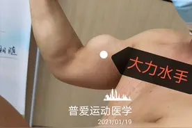 练成了大力水手？可能是你肌腱断了图片