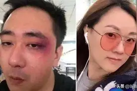著名脱口秀主持人，遭妻子扇500耳光，被烟头烫6次，曾进医院8次图片