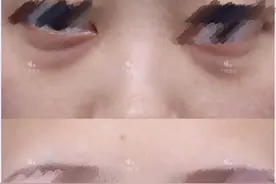 50岁皮肤还能拯救吗？黑眼圈眼袋、皮肤下垂、老化、皱纹怎么办图片