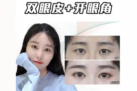 平扇、开扇形双眼皮都属于自然款，如何选择不后悔？图片