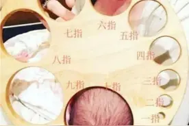 丈夫问医生：开十指是什么意思？医生拿出示意图后，丈夫红了眼眶图片